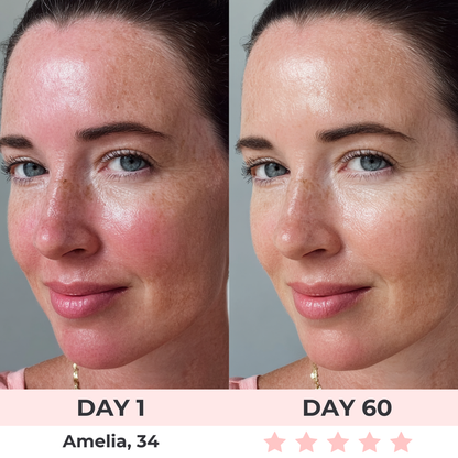 Aevura Studio™ - LED Face Mask